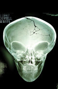X Files (2026) #1 Cover U Inc 1:50 Roswell Photo Metal Premium Variant (Net)